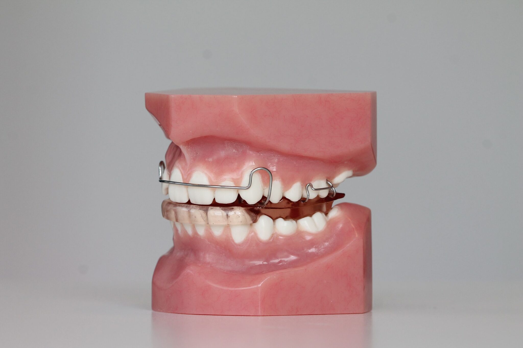 Soorten beugels Ortho aan de Zaan