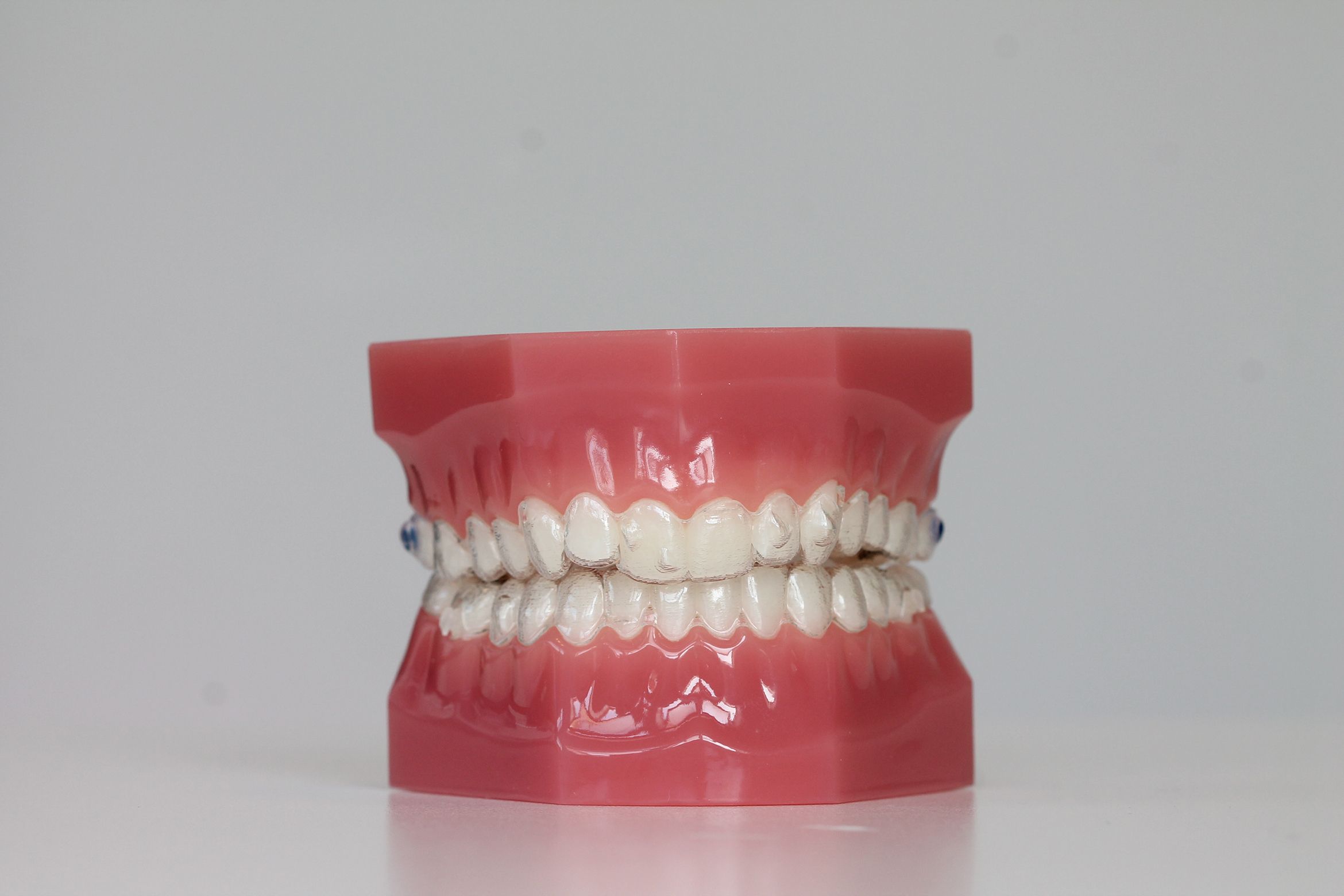 ortho-aan-de-zaan-invisalign